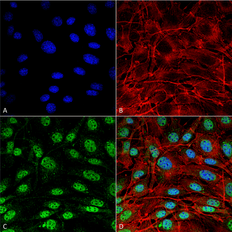 Immunocytochemistry/Immunofluorescence - Anti-SQSTM1 / p62 Antibody (A305009) - Antibodies.com