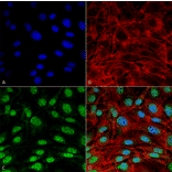 Immunocytochemistry/Immunofluorescence - Anti-SQSTM1 / p62 Antibody (A305009) - Antibodies.com
