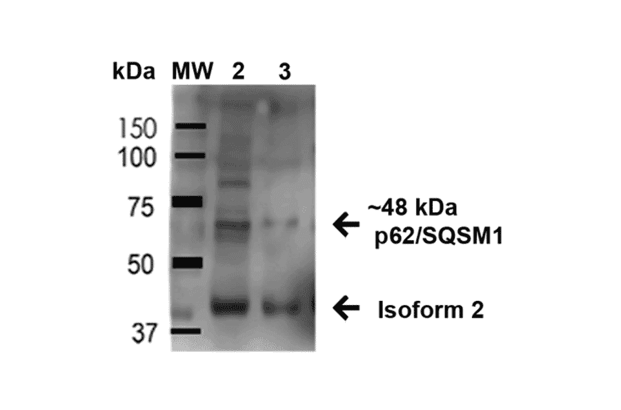 Western Blot - Anti-SQSTM1 / p62 Antibody (A305009) - Antibodies.com