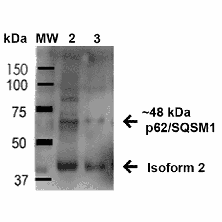 Western Blot - Anti-SQSTM1 / p62 Antibody (A305009) - Antibodies.com