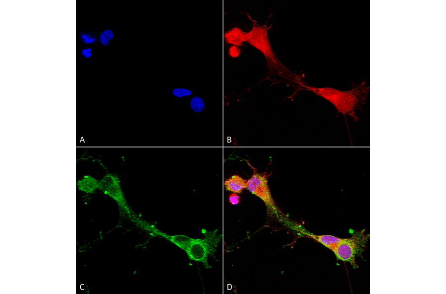 Immunocytochemistry/Immunofluorescence - Anti-ASIC1 Antibody [S271-44] (A305010) - Antibodies.com