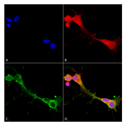 Immunocytochemistry/Immunofluorescence - Anti-ASIC1 Antibody [S271-44] (A305010) - Antibodies.com
