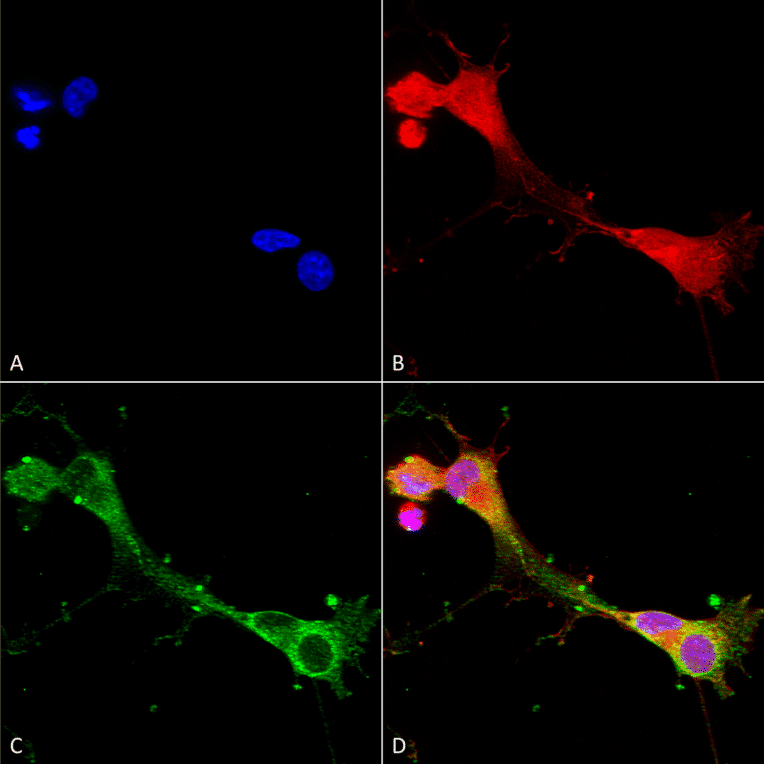 Immunocytochemistry/Immunofluorescence - Anti-ASIC1 Antibody [S271-44] (A305010) - Antibodies.com