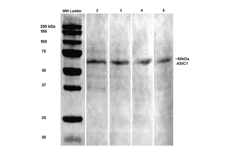 Western Blot - Anti-ASIC1 Antibody [S271-44] (A305010) - Antibodies.com