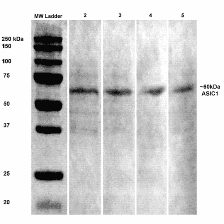 Western Blot - Anti-ASIC1 Antibody [S271-44] (A305010) - Antibodies.com