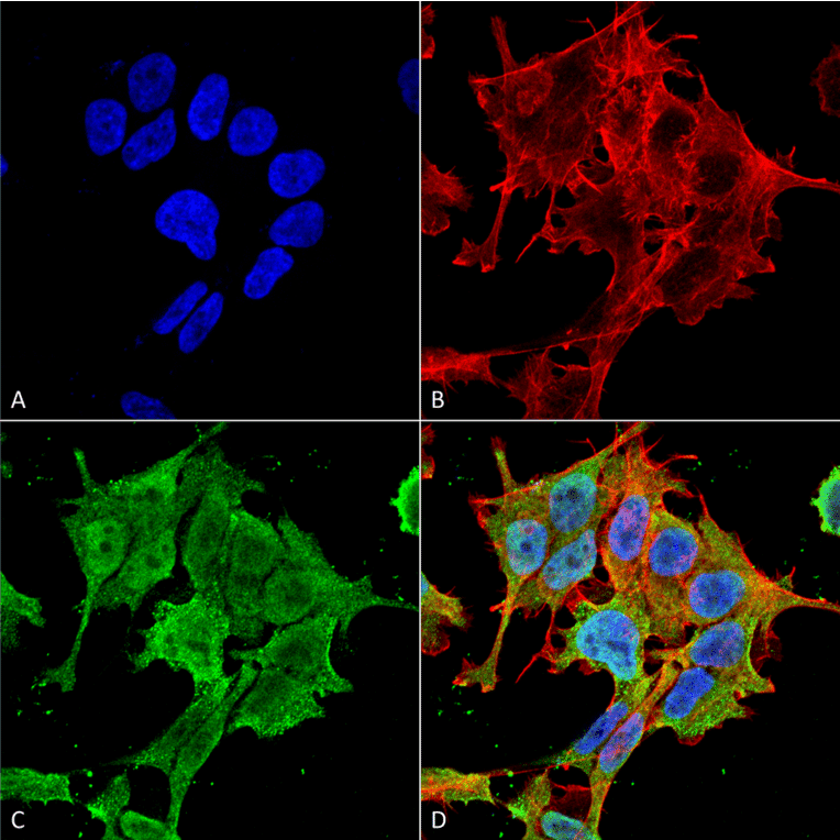 Immunocytochemistry/Immunofluorescence - Anti-ASIC1 Antibody [S271-44] (A305010) - Antibodies.com