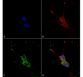 Immunocytochemistry/Immunofluorescence - Anti-LGI1 Antibody [S283-7] (A305011) - Antibodies.com