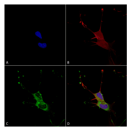 Immunocytochemistry/Immunofluorescence - Anti-LGI1 Antibody [S283-7] (A305011) - Antibodies.com