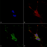 Immunocytochemistry/Immunofluorescence - Anti-LGI1 Antibody [S283-7] (A305011) - Antibodies.com