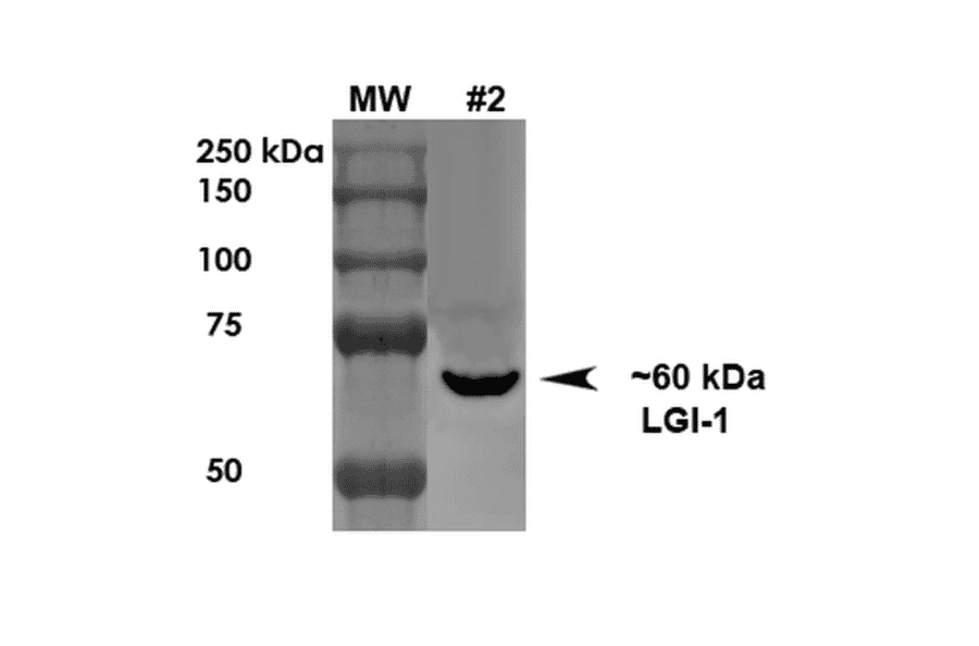 Western Blot - Anti-LGI1 Antibody [S283-7] (A305011) - Antibodies.com