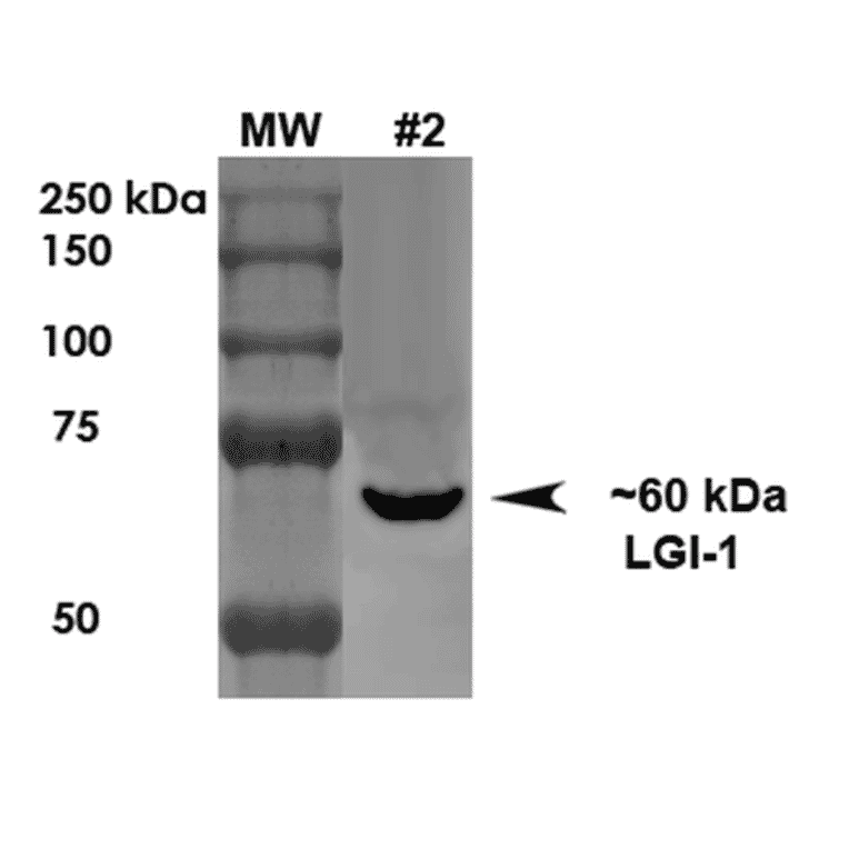 Western Blot - Anti-LGI1 Antibody [S283-7] (A305011) - Antibodies.com