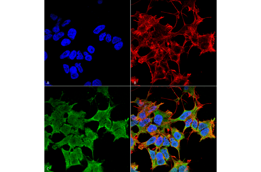 Immunocytochemistry/Immunofluorescence - Anti-LGI1 Antibody [S283-7] (A305011) - Antibodies.com