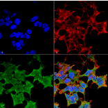 Immunocytochemistry/Immunofluorescence - Anti-LGI1 Antibody [S283-7] (A305011) - Antibodies.com
