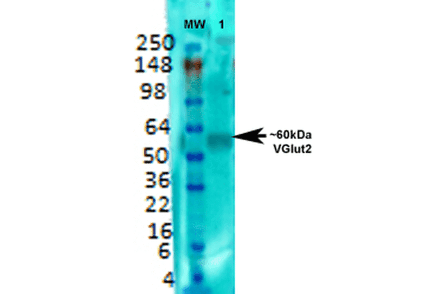 Western Blot - Anti-VGLUT2 Antibody [S29-29] (A305012) - Antibodies.com