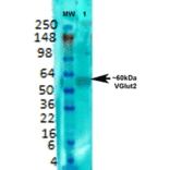 Western Blot - Anti-VGLUT2 Antibody [S29-29] (A305012) - Antibodies.com