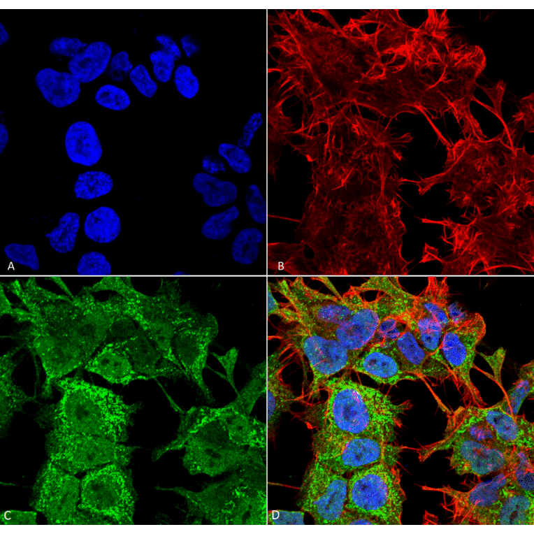 Immunocytochemistry/Immunofluorescence - Anti-AMIGO1 Antibody [S86-36] (A305013) - Antibodies.com