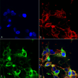 Immunocytochemistry/Immunofluorescence - Anti-AMIGO1 Antibody [S86-36] (A305013) - Antibodies.com