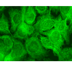 Immunocytochemistry/Immunofluorescence - Anti-TRPV3 Antibody [N15/39] (A305015) - Antibodies.com