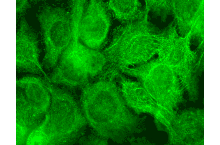 Immunocytochemistry/Immunofluorescence - Anti-TRPV3 Antibody [N15/39] (A305015) - Antibodies.com