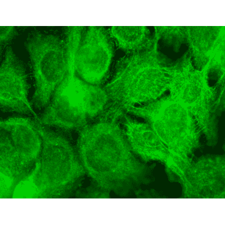 Immunocytochemistry/Immunofluorescence - Anti-TRPV3 Antibody [N15/39] (A305015) - Antibodies.com