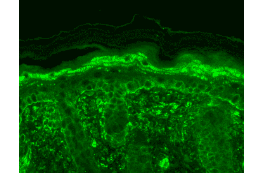 Immunohistochemistry - Anti-TRPV3 Antibody [N15/39] (A305015) - Antibodies.com