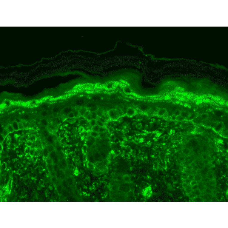 Immunohistochemistry - Anti-TRPV3 Antibody [N15/39] (A305015) - Antibodies.com