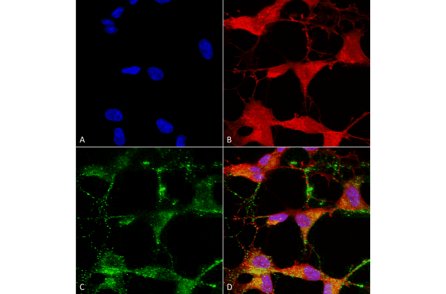 Immunocytochemistry/Immunofluorescence - Anti-TRPV3 Antibody [N15/39] (A305015) - Antibodies.com