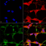 Immunocytochemistry/Immunofluorescence - Anti-TRPV3 Antibody [N15/39] (A305015) - Antibodies.com
