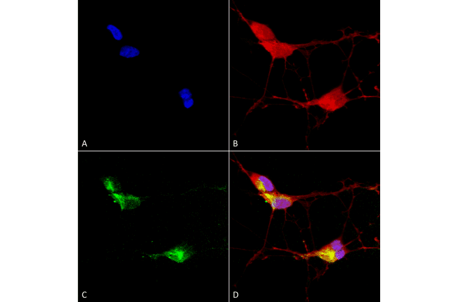 Immunocytochemistry/Immunofluorescence - Anti-TRPV3 Antibody [N15/4] (A305016) - Antibodies.com