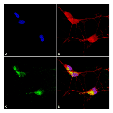 Immunocytochemistry/Immunofluorescence - Anti-TRPV3 Antibody [N15/4] (A305016) - Antibodies.com