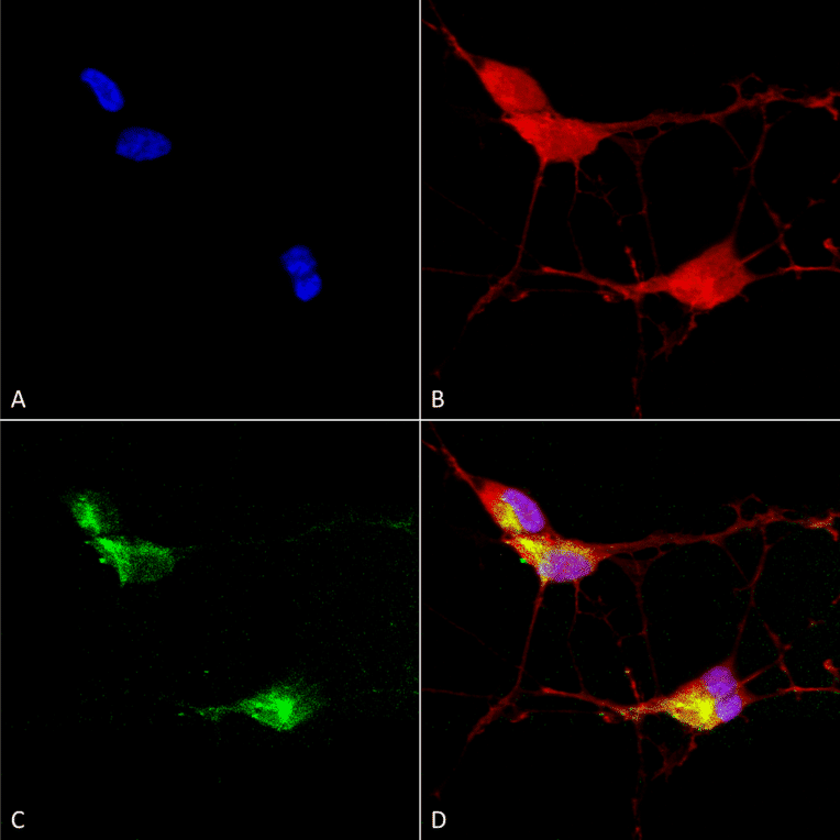 Immunocytochemistry/Immunofluorescence - Anti-TRPV3 Antibody [N15/4] (A305016) - Antibodies.com