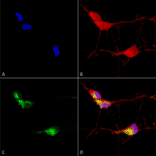 Immunocytochemistry/Immunofluorescence - Anti-TRPV3 Antibody [N15/4] (A305016) - Antibodies.com