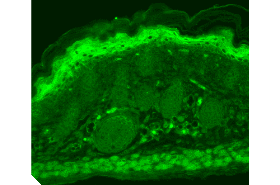 Immunohistochemistry - Anti-TRPV3 Antibody [N15/4] (A305016) - Antibodies.com
