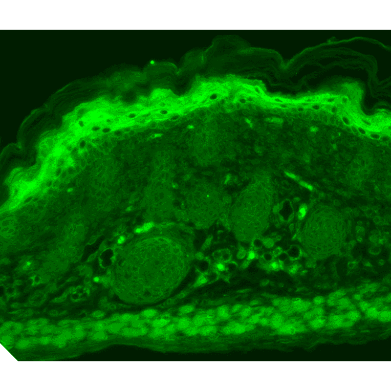 Immunohistochemistry - Anti-TRPV3 Antibody [N15/4] (A305016) - Antibodies.com