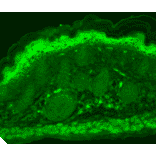 Immunohistochemistry - Anti-TRPV3 Antibody [N15/4] (A305016) - Antibodies.com