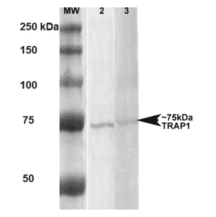 Western Blot - Anti-TRAP1 Antibody [3H4-2H6] (A305019) - Antibodies.com