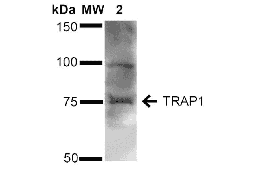 Western Blot - Anti-TRAP1 Antibody (A305020) - Antibodies.com