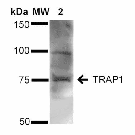 Western Blot - Anti-TRAP1 Antibody (A305020) - Antibodies.com