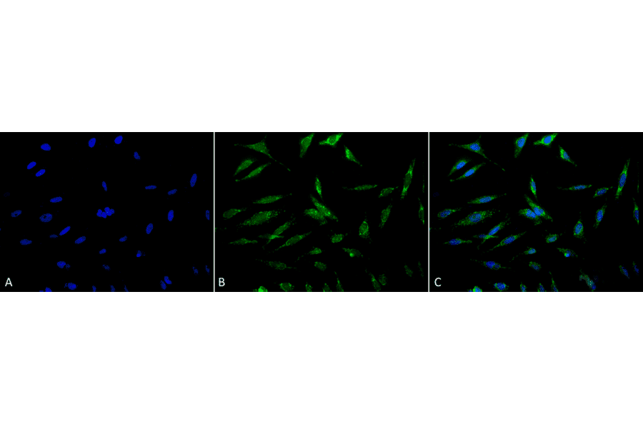 Immunocytochemistry/Immunofluorescence - Anti-TRAP1 Antibody (A305020) - Antibodies.com