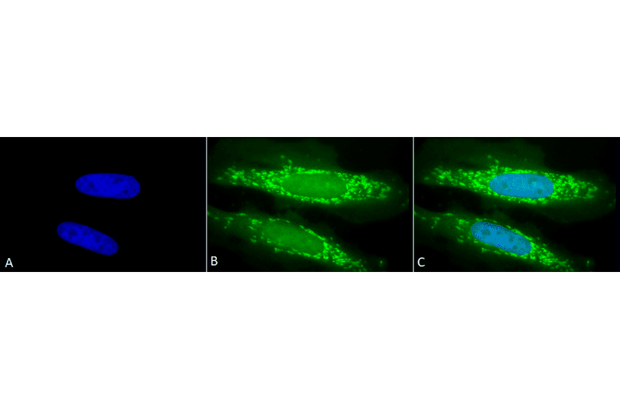 Immunocytochemistry/Immunofluorescence - Anti-TRAP1 Antibody (A305020) - Antibodies.com