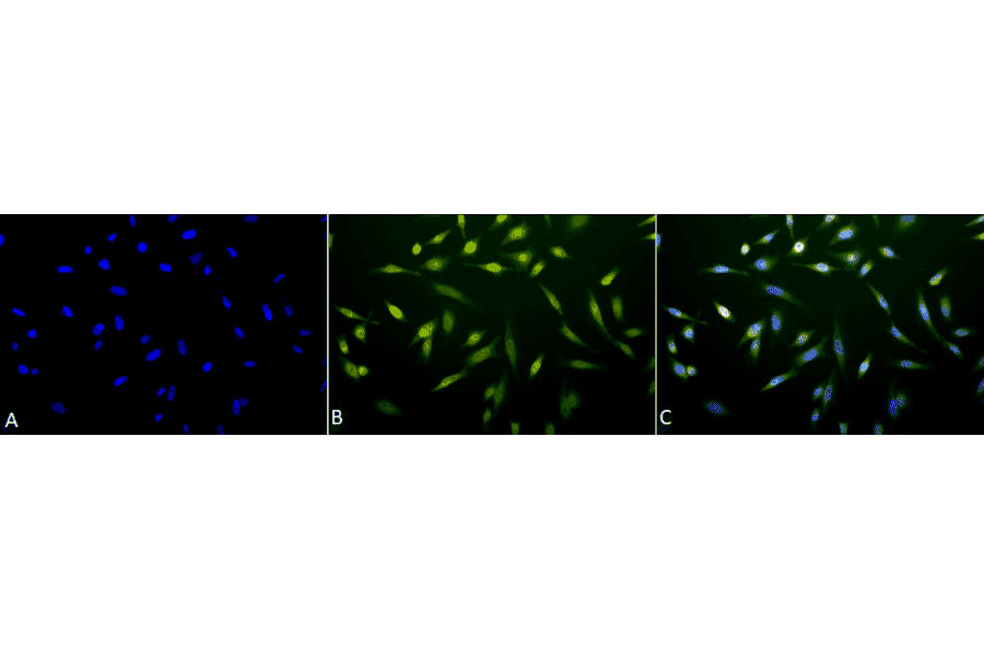 Immunocytochemistry/Immunofluorescence - Anti-Cytochrome P450 Reductase Antibody (A305022) - Antibodies.com