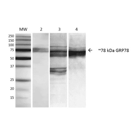Western Blot - Anti-GRP78 Antibody [3C5-1A4] (A305024) - Antibodies.com