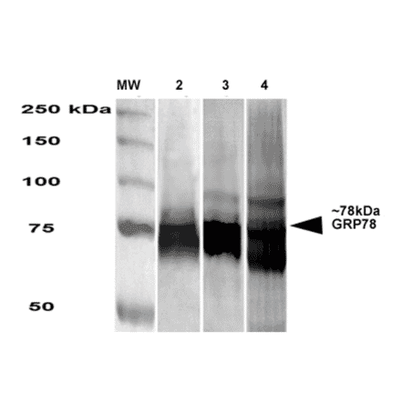 Western Blot - Anti-GRP78 Antibody [3G12-1G11] (A305025) - Antibodies.com