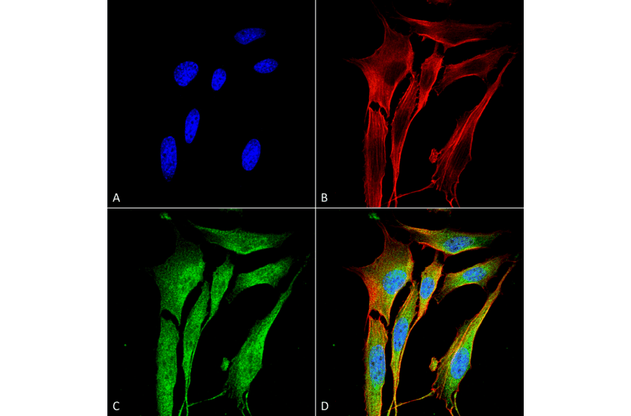 Immunocytochemistry/Immunofluorescence - Anti-MMP9 Antibody [S51-82] (A305026) - Antibodies.com