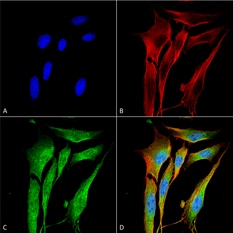 Immunocytochemistry/Immunofluorescence - Anti-MMP9 Antibody [S51-82] (A305026) - Antibodies.com