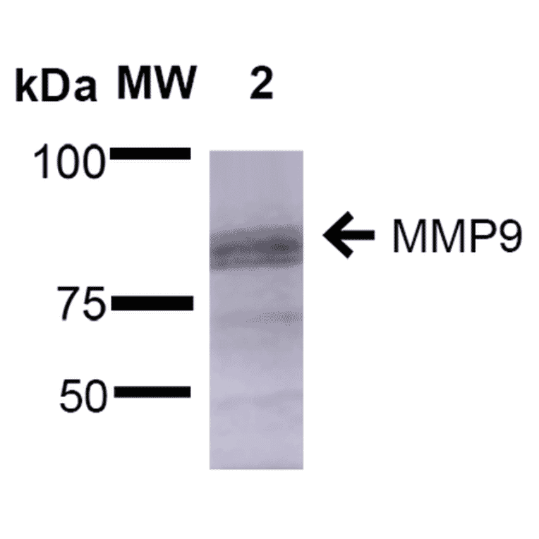 Western Blot - Anti-MMP9 Antibody [S51-82] (A305026) - Antibodies.com