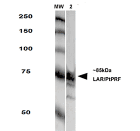 Western Blot - Anti-LAR Antibody [S165-38] (A305027) - Antibodies.com