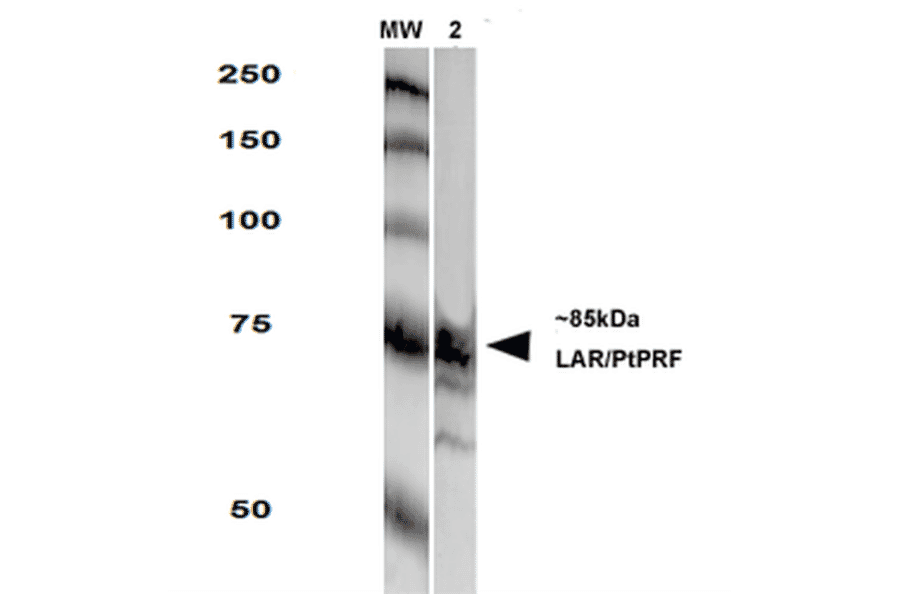 Western Blot - Anti-LAR Antibody [S165-38] (A305027) - Antibodies.com