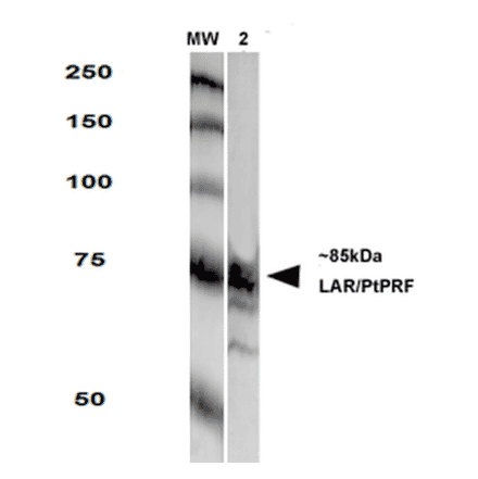 Western Blot - Anti-LAR Antibody [S165-38] (A305027) - Antibodies.com