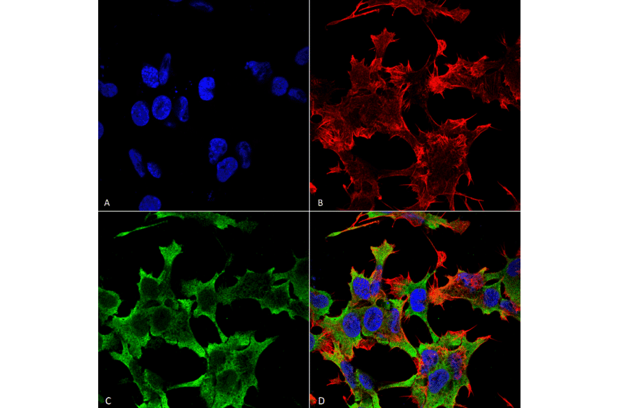Immunocytochemistry/Immunofluorescence - Anti-LAR Antibody [S165-38] (A305027) - Antibodies.com